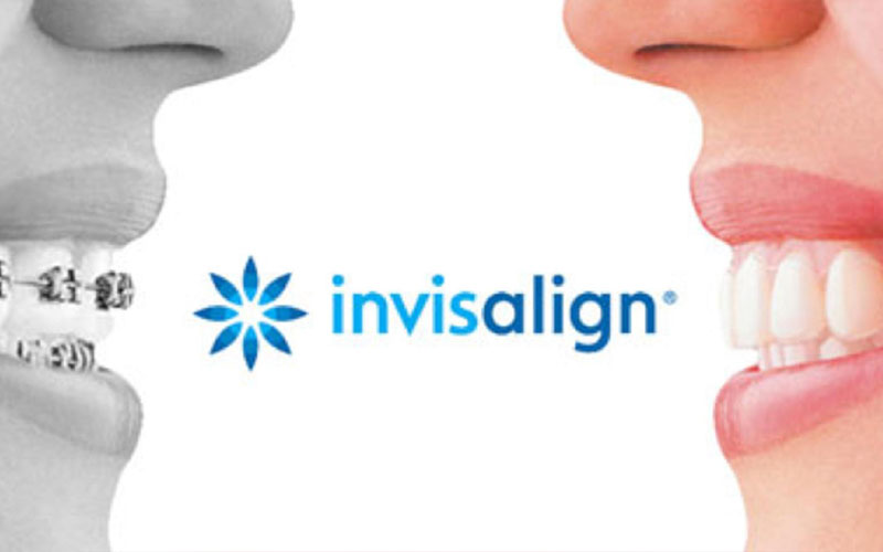 Invisalign